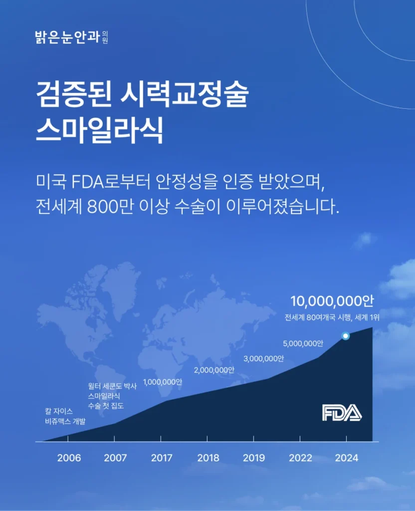 스마일라식 원리