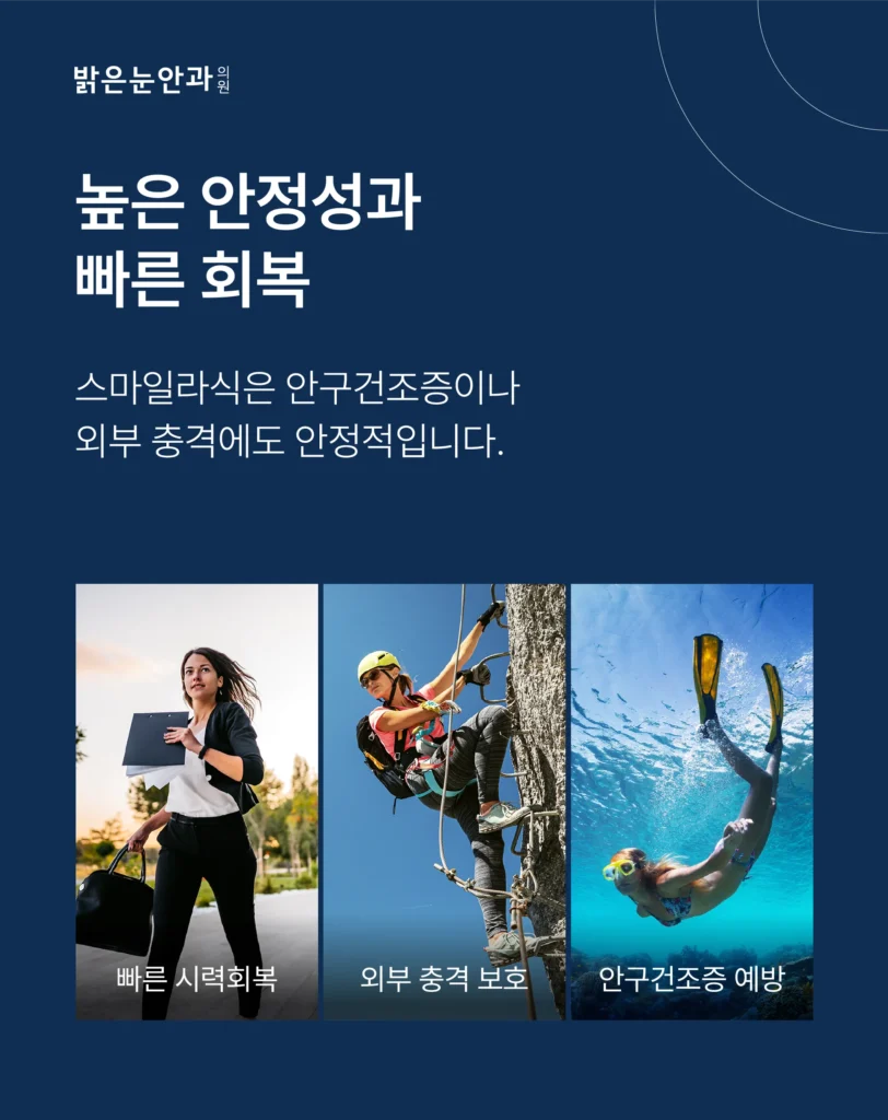 스마일라식 원리