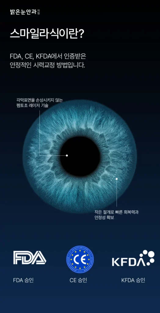 스마일라식 사전 검사