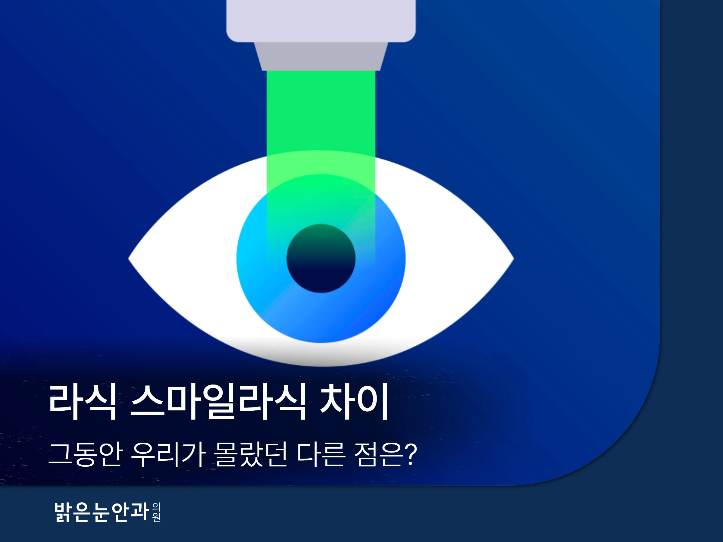 라식 스마일라식 차이 1