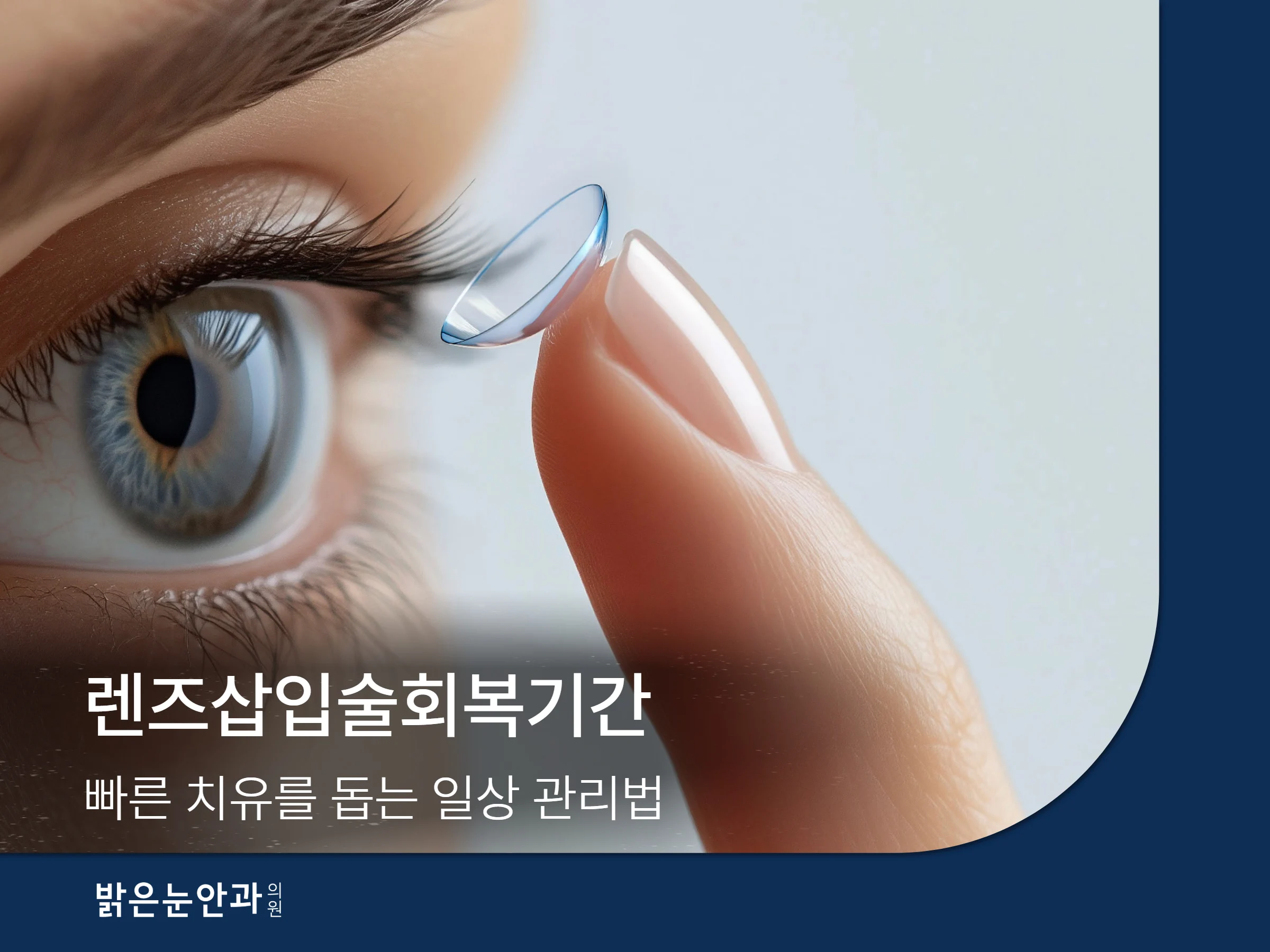 렌즈삽입술회복기간 썸네일