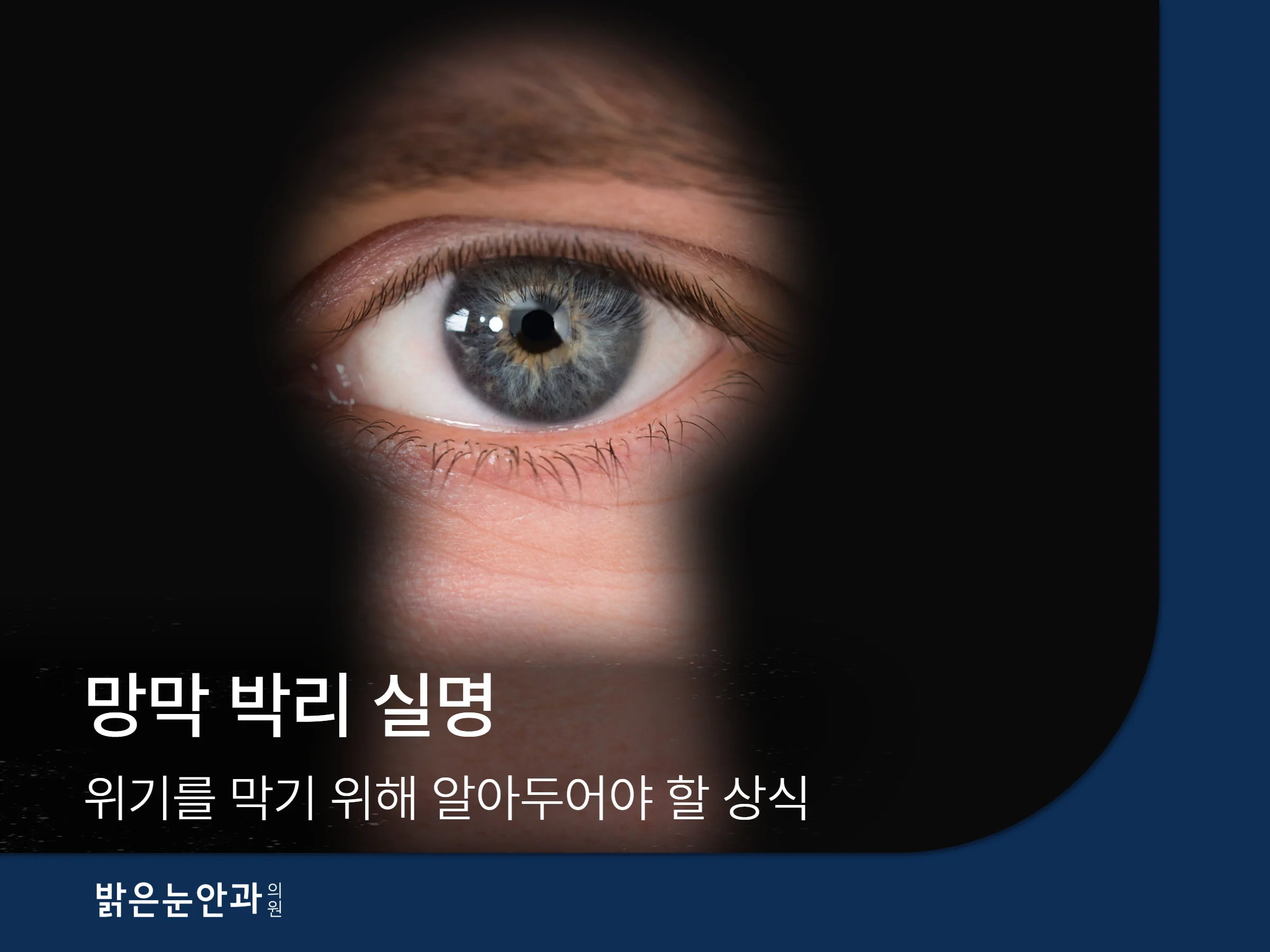 망막 박리 실명