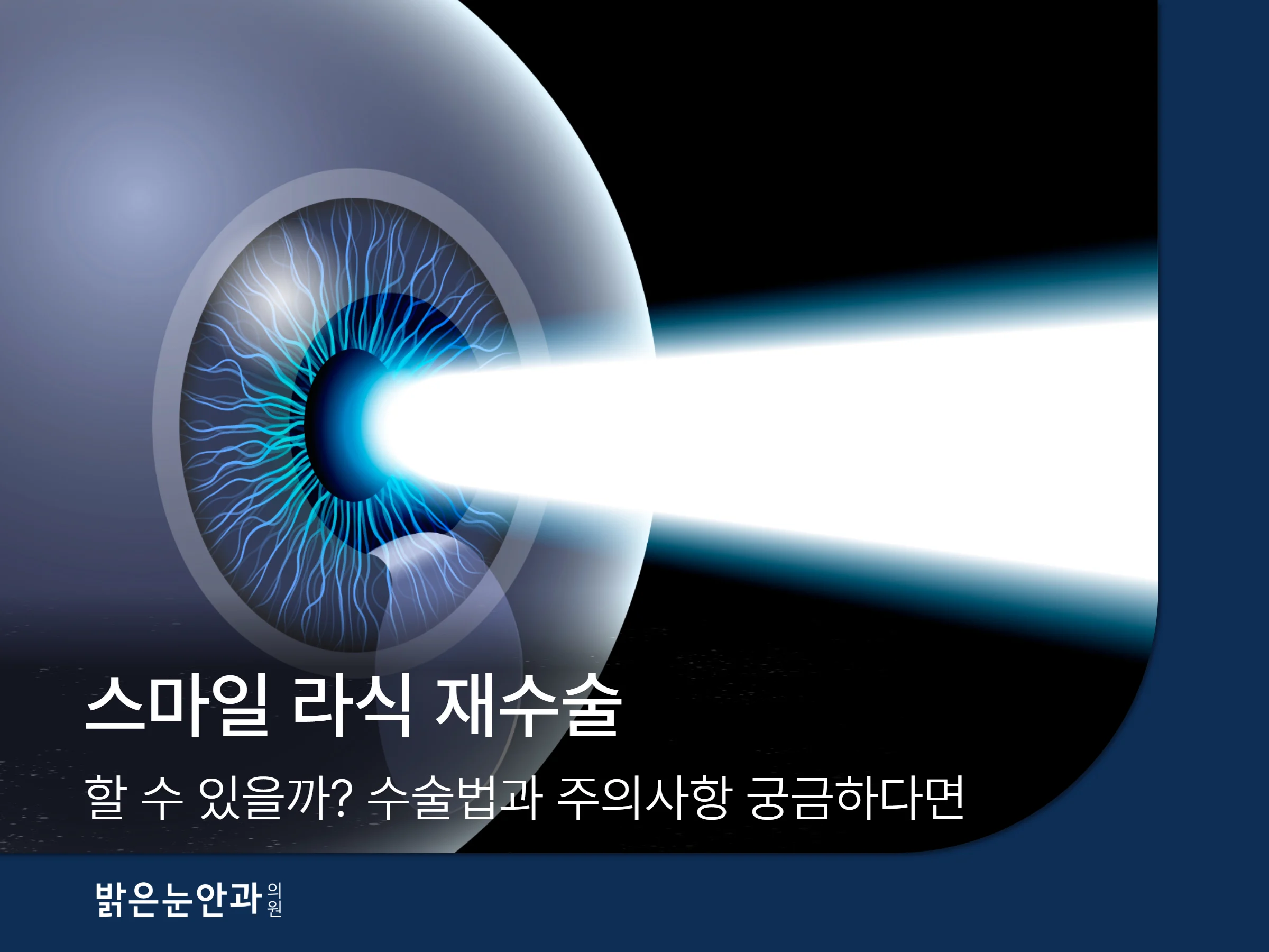 스마일 라식 재수술