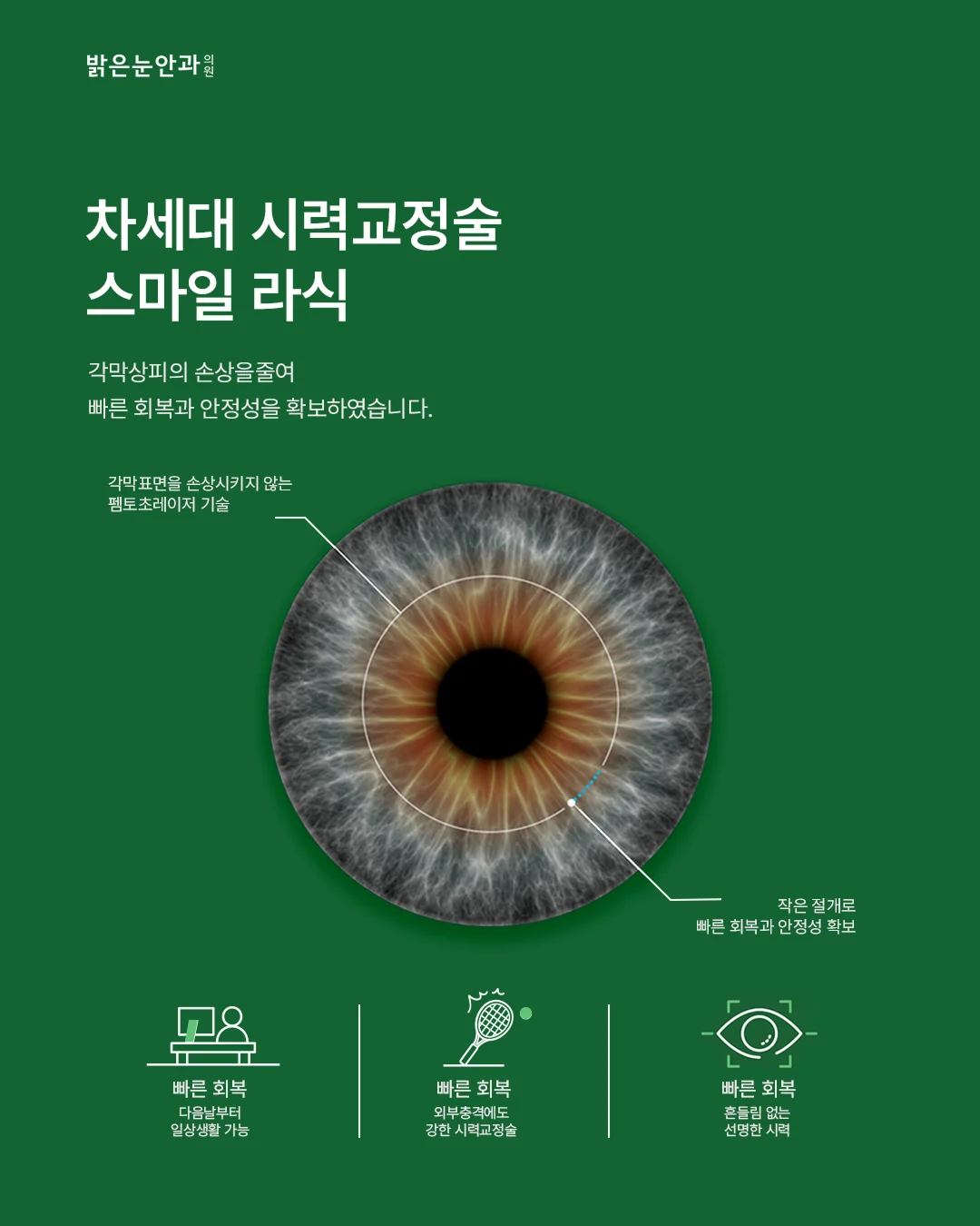 스마일 라식 vs 라섹