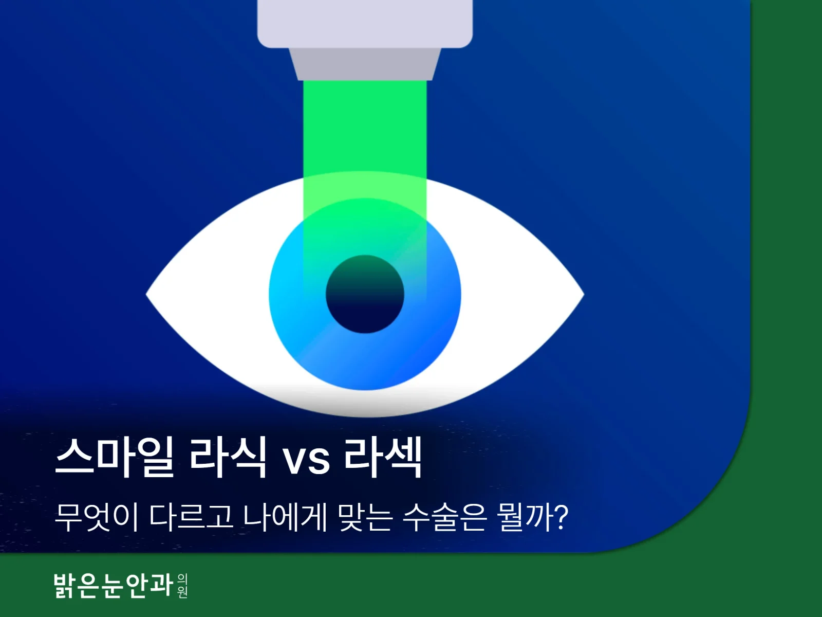 라식스마일라식차이