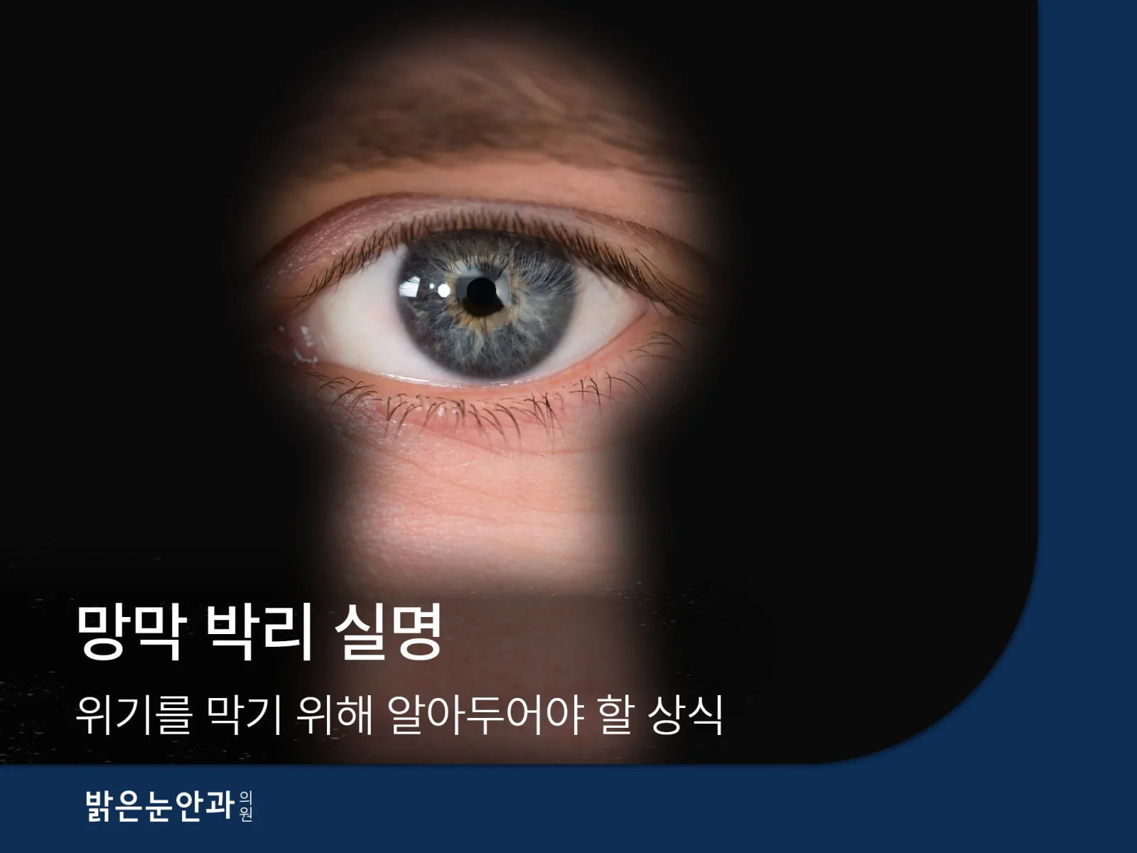 망막 박리 실명