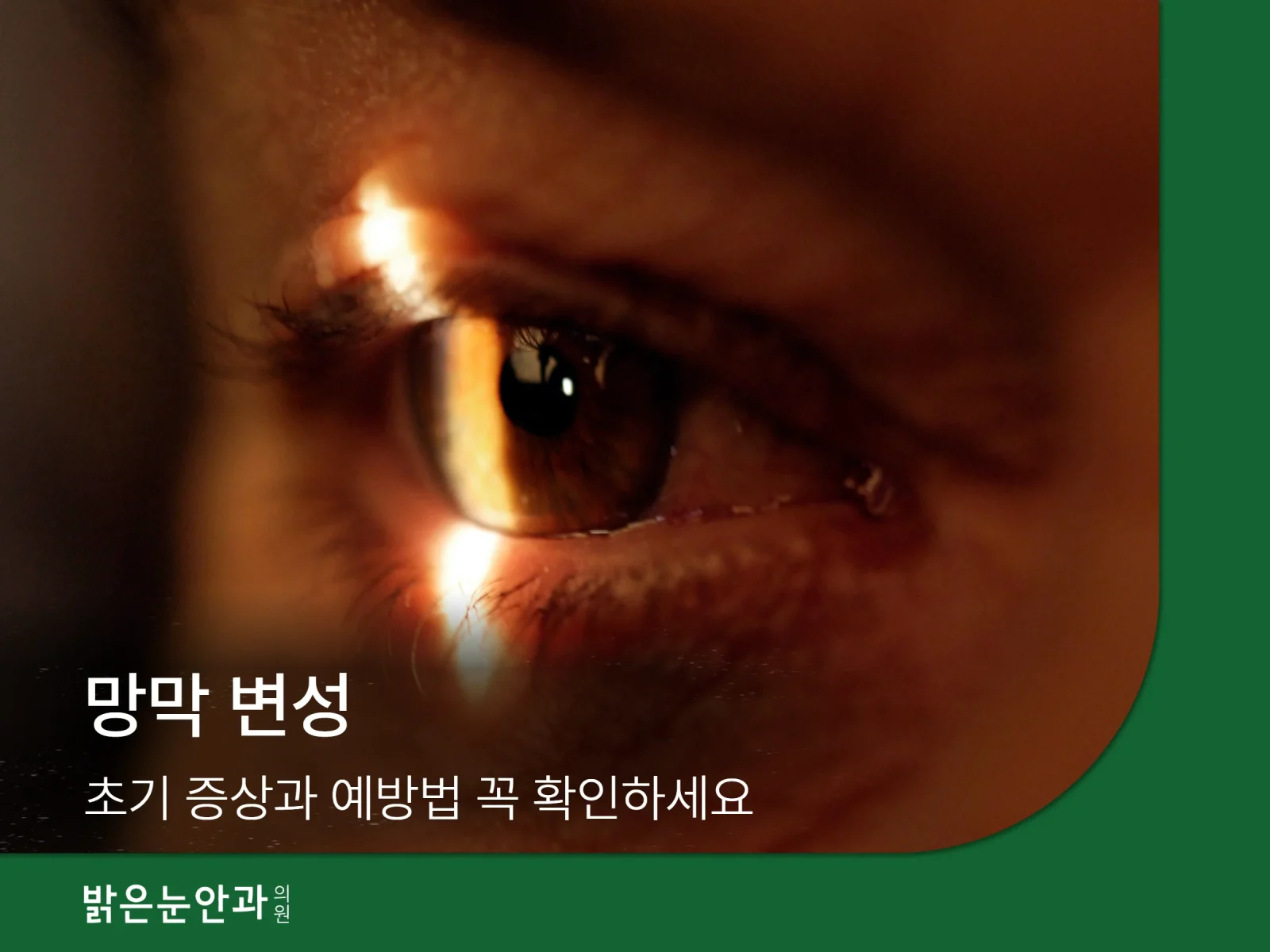 망막변성