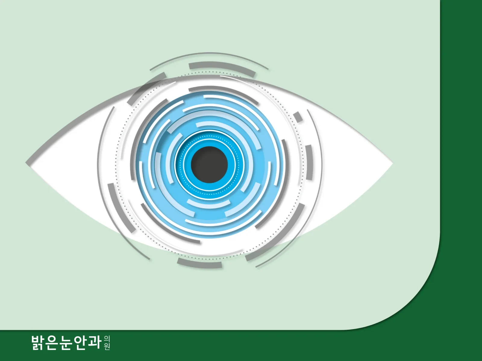 백내장 단초점 렌즈
