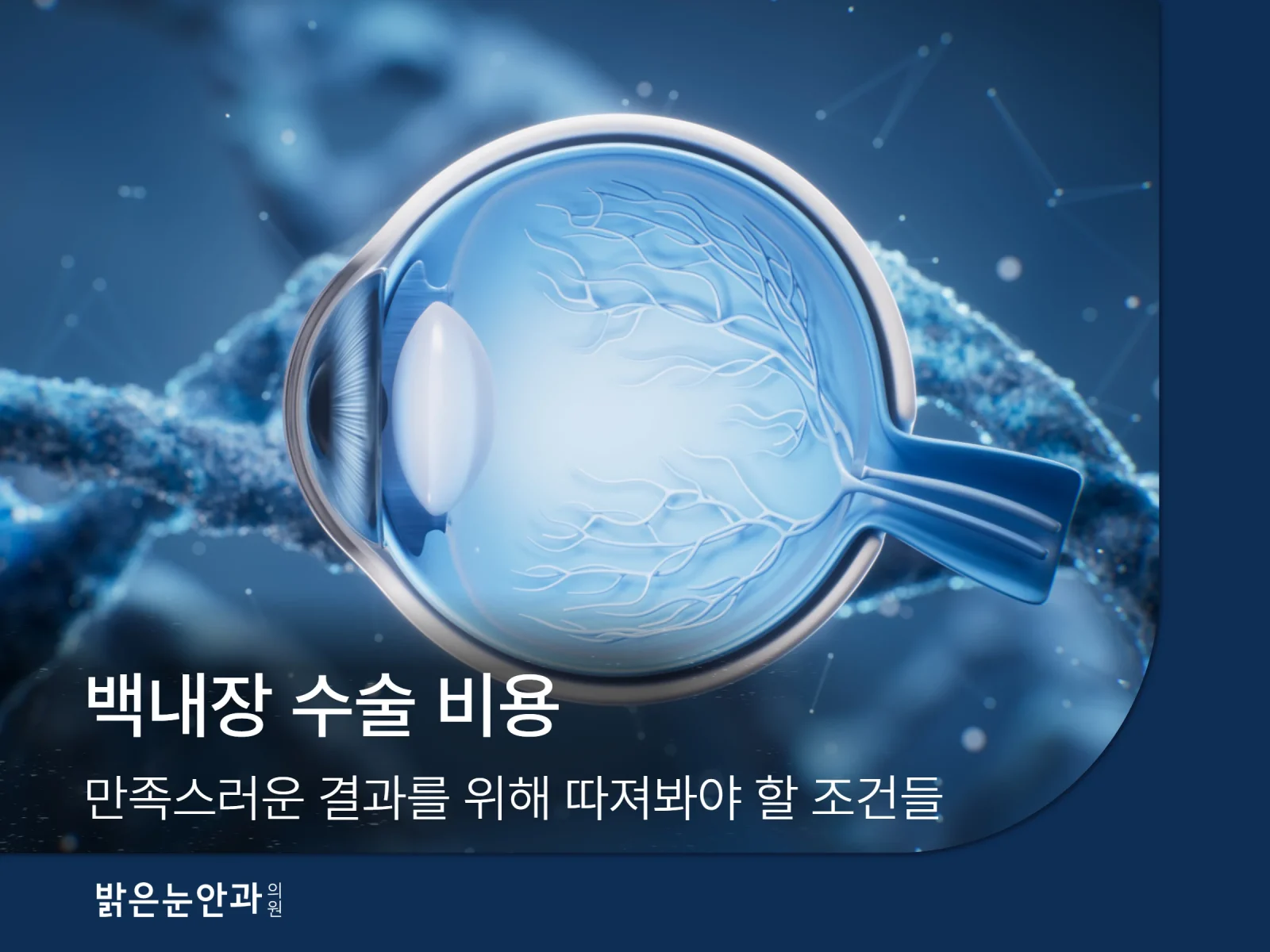 백내장 수술 비용