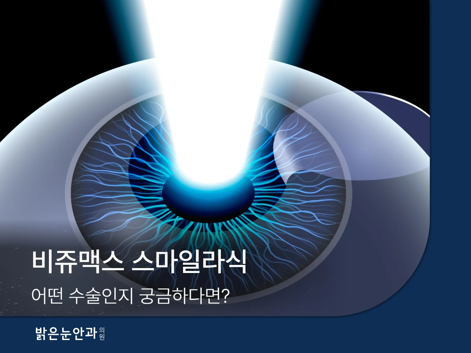 비쥬맥스 스마일라식