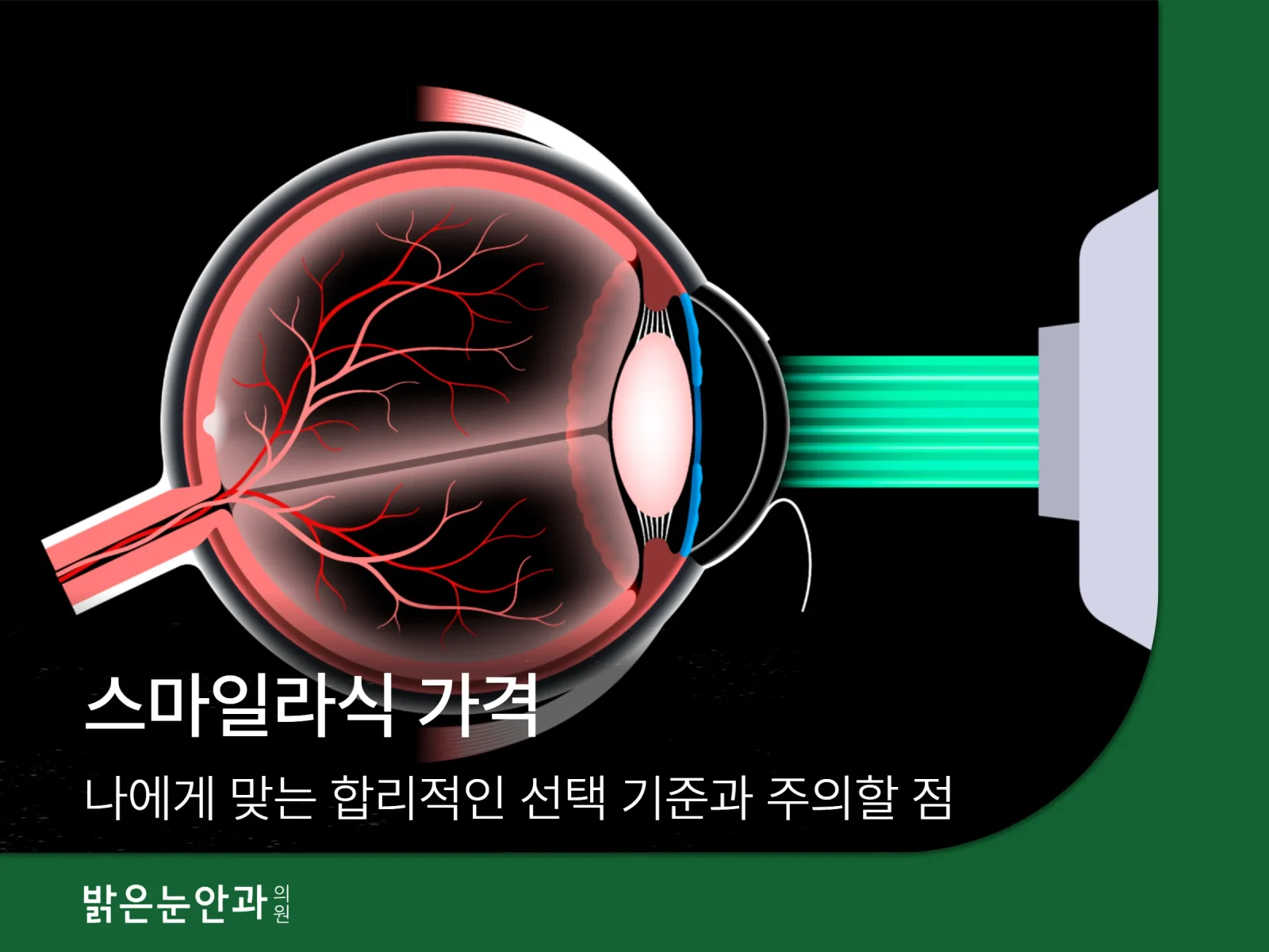 스마일라식 가격