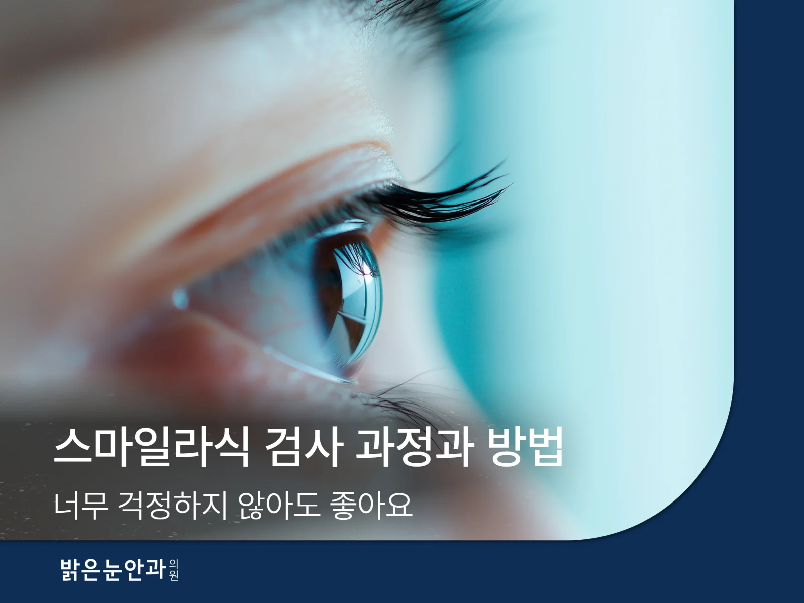 스마일라식 검사