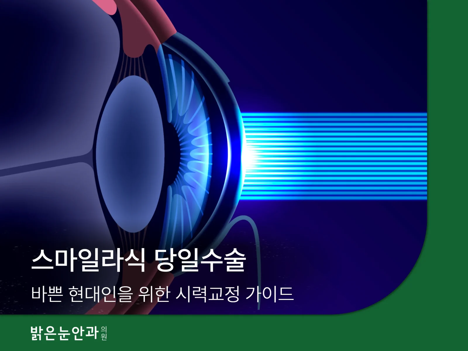 스마일라식 당일수술