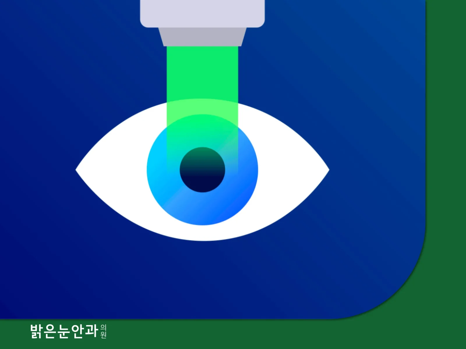 스마일라식 라식 차이