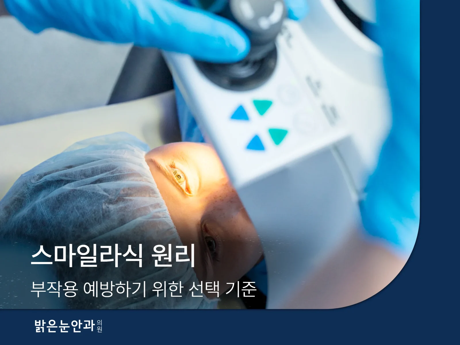 스마일라식 원리