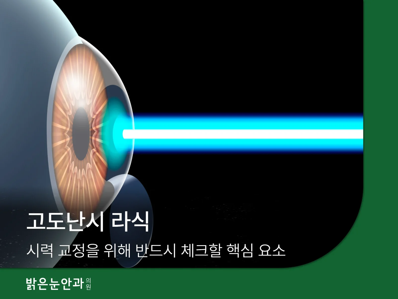 스마일라식 회복기간