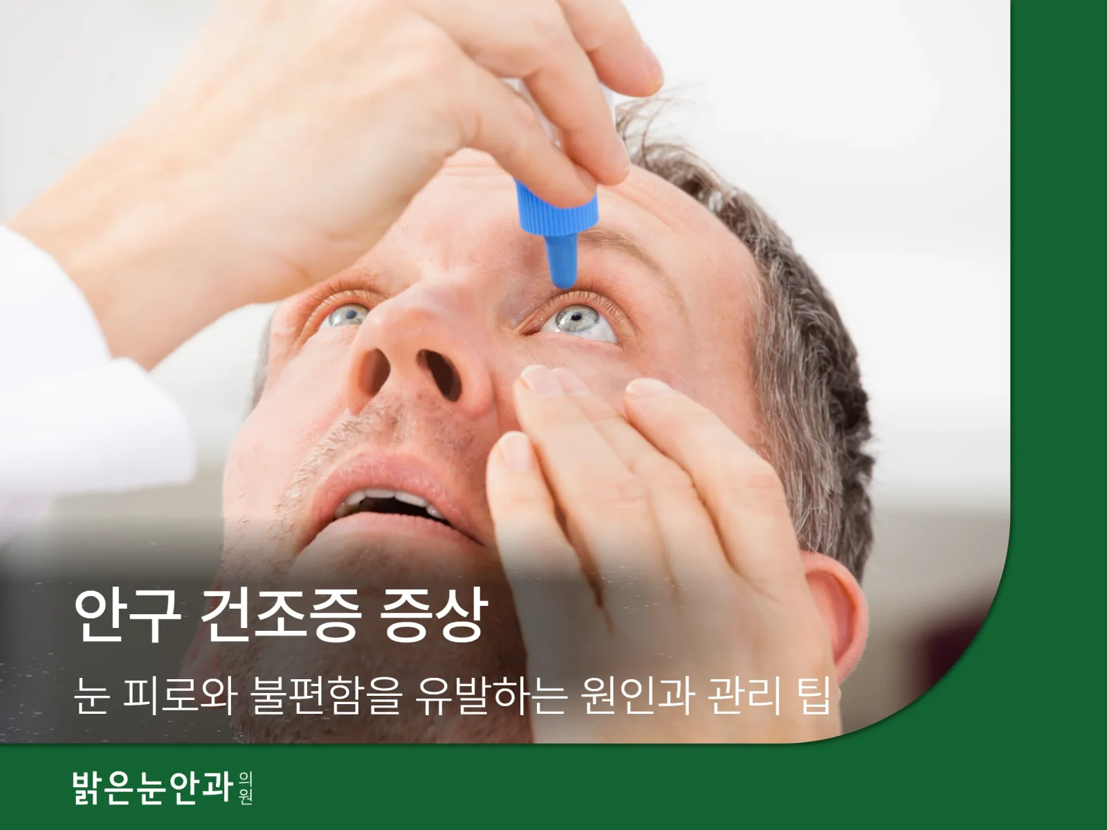 안구 건조증 증상 (2)