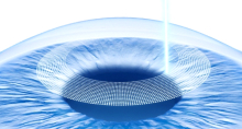 Visumax